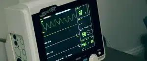 abnormal ekg